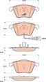 TRW Bremsbelagsatz Scheibenbremse COTEC GDB1809 für SCIROCCO A3 AUDI GOLF VW TT