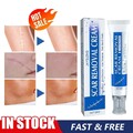 30g SCAR REMOVAL CREAM SkinRepair Scar Remover丨Acne Treatment丨FadeStretchMark
