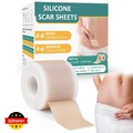 Silikon-Gel Narbenpflaster Selbstklebend Narbe Entfernen für Schnelle Heilung