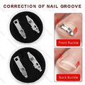 4 Nagelspange Nagel Fixer Eingewachsene Zehennagel Korrektur Pediküre Fuß Pflege