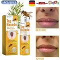 1/2x Tag Recede Bienengift Spray, natürlicher Extrakt, für alle Hauttypen 20ml