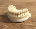 Zahnprothese Zahnersatz Prothese Oberkiefer Dental Gebiss Kronen Brücken