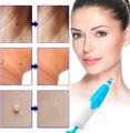 Stielwarzen Entferner, Skin Tag Entferner, 2-in-1 Stielwarzen Entfernen schnell