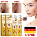 1/2X Tag Recede Bienengift Spray Tag Recede natürlicher Extrakt Bienengift Spray