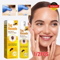 1/2Tlg Tag Recede Bienengift Spray natürlicher Extrakt Spray für alle Hauttypen