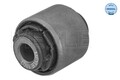MEYLE Lagerung, Lenker 35-147100007