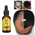 Ingwer Haarwachstum Serum Haarwuchs Serum für dünnes Haar stärken 10/20/40ML