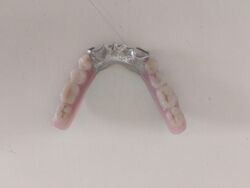 Zahnprothese Unterkiefer Gebiss. #24