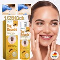 1/2X Tag Recede Bienengift Spray, natürlicher Extrakt, für alle Hauttypen 20ml