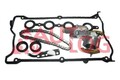 AUTLOG KT1001 Steuerkettensatz Steuerkette für VW Golf IV Schrägheck (1J1)